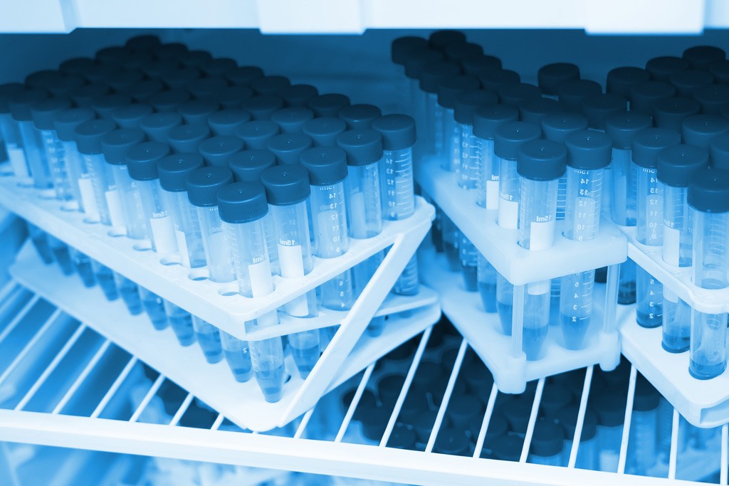 Guide to Medication Fridge Temperature & Thermometers