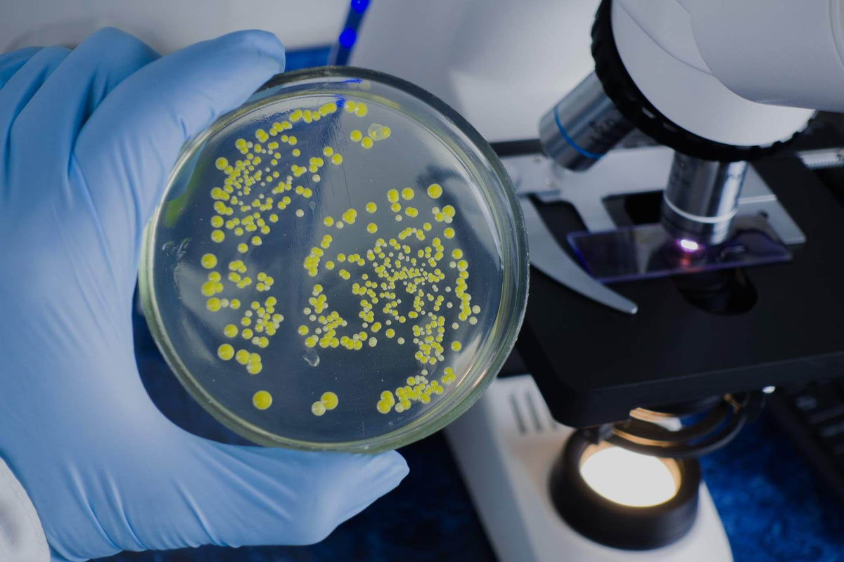 Bacterial culture plate held by a gloved hand with a microscope in the background